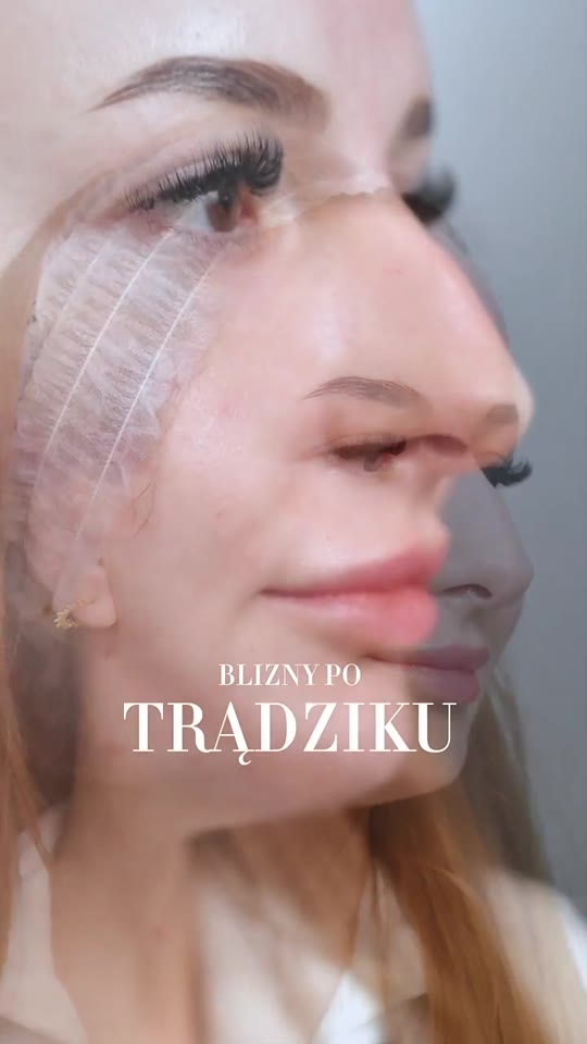 A close-up of a facial skincare treatment